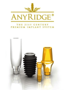 Anyridge Dental Implant technology, The 21st Century Premium Implant System